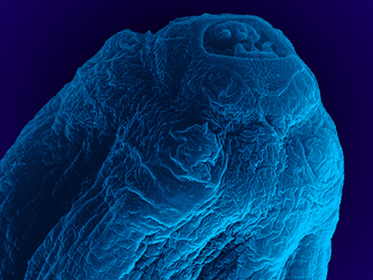 Imagem do parasito ampliada em microscópio