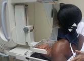 Mulher de costas realizando exame de mamografia com auxílio de enfermeira