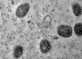 Vírus monkeypox visto pelo microscópio