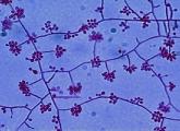 Vírus da esporotricose visto pelo microscópio