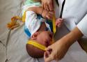 Bebê tendo a cabeça medida por uma médica