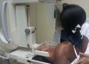 Mulher de costas realizando exame de mamografia com auxílio de enfermeira