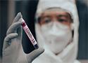 Técnico de laboratório em traje de EPI segurando amostra de sangue contendo Covid-19