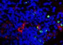 Imagem de neurônios atacados pelo vírus zika ampliada por microscópio