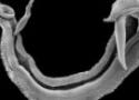 Schistosoma mansoni visto por microscópio