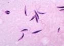 Grupo de 'Leishmania' em fase de evolução conhecida como promastigota