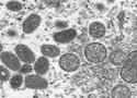 Vírus visto pelo microscópio