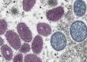 Vírus monkeypox visto pelo microscópio