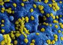 Vírus ampliado por microscópio
