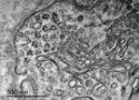 Vírus zika visto por microscópio